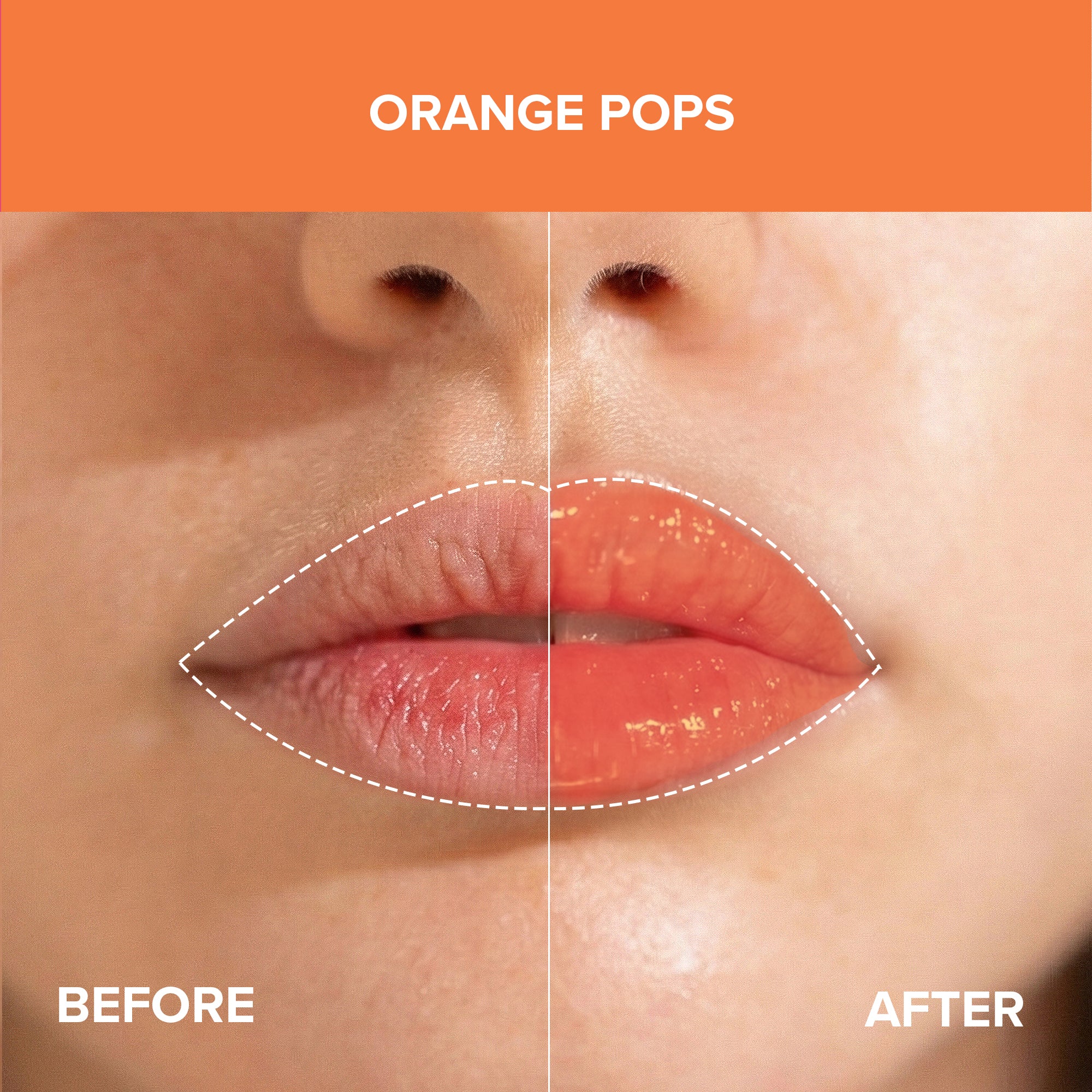ORANGE POPS